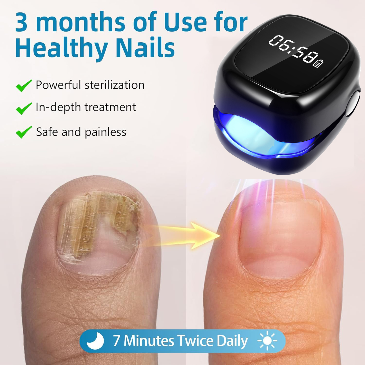 UV Laser Nail Fungus Removal D – Industrial Laser Removal recenzja i cena