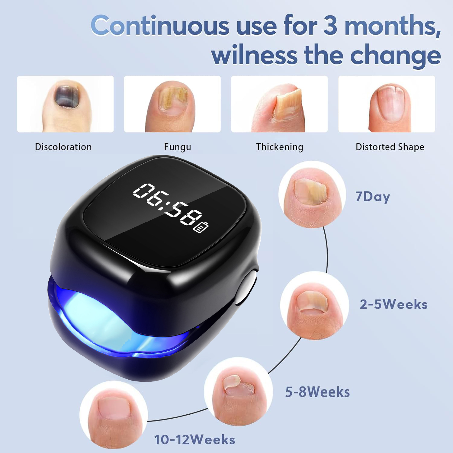 UV Laser Nail Fungus Removal D – Industrial Laser Removal recenzja i cena