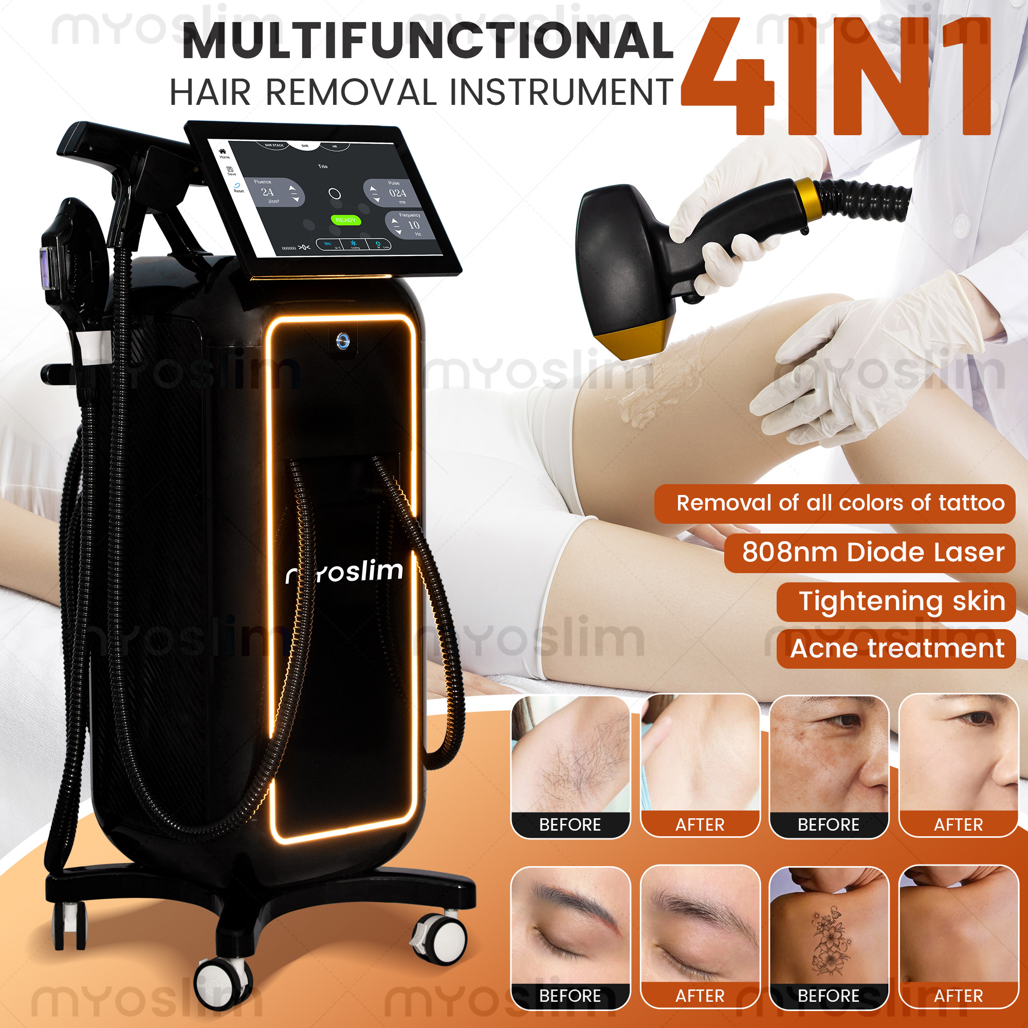 Soprano 4 in 1  Diode Laser Ha – Industrial Laser Cleaning Machine recenzja i cena