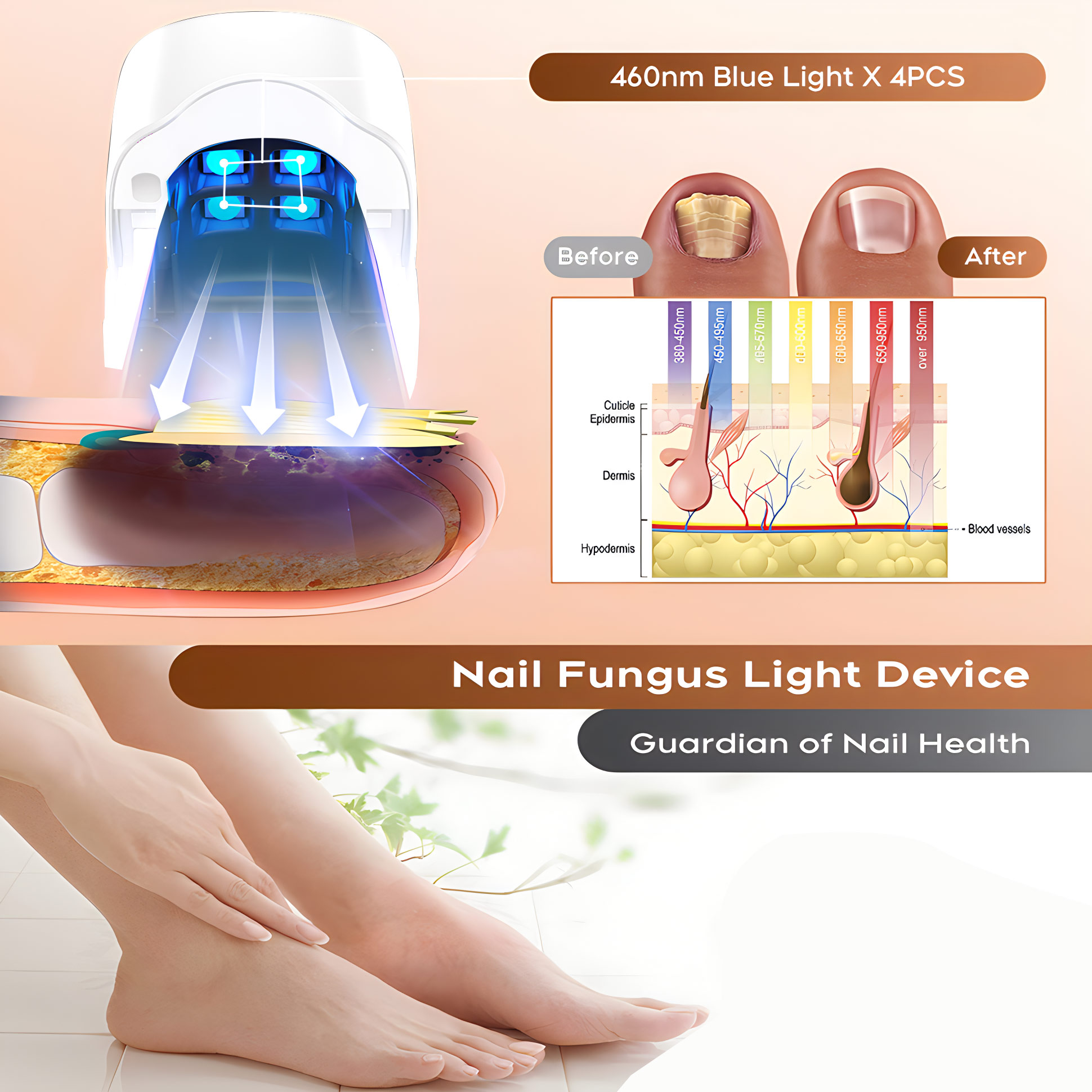 Nail Fungus Laser Assist Tool  – Industrial Laser Removal recenzja i cena